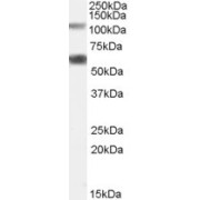 abx431038 (0.05 µg/ml) staining of Rat Pancreas lysate (35 µg protein in RIPA buffer). Detected by chemiluminescence.