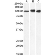 Western blot analysis of Jurkat (A), MCF7 (B) and MOLT4 (C) cell lysate (35 µg in RIPA buffer) using C-1-Tetrahydrofolate Synthase, Cytoplasmic (MTHFD1) Antibody (1 µg/ml).