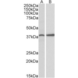 Protein Kinase C Delta-Binding Protein (PRKCDBP) Antibody