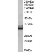 abx431055 (0.1 µg/ml) staining of Human Colon lysate (35 µg protein in RIPA buffer). Detected by chemiluminescence.