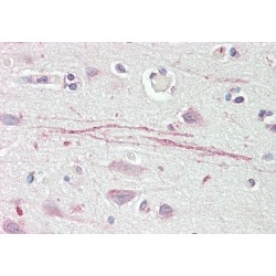 Acid-Sensing Ion Channel 1 (ASIC1) Antibody