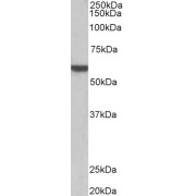 abx431080 (0.1 µg/ml) staining of Pig Heart lysate (35 µg protein in RIPA buffer). Primary incubation was 1 hour. Detected by chemiluminescence.