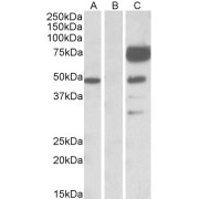 HEK293 lysate (10 µg protein in RIPA buffer) overexpressing Human ANGPT1 with DYKDDDDK tag probed with abx431083 (1 µg/ml) in Lane A and probed with anti- DYKDDDDK Tag (1/1000) in lane C. Mock-transfected HEK293 probed with abx431083 (1mg/ml) in Lane B. Primary incubations were for 1 hour. Detected by chemiluminescence.