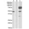 Angiopoietin-1 (ANGPT1) Antibody