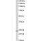 Metalloproteinase Inhibitor 1 (TIMP1) Antibody