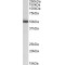 Aldehyde Dehydrogenase, Mitochondrial (ALDH2) Antibody