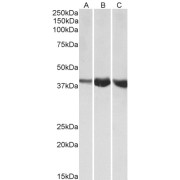 abx431091 (1 µg/ml) staining of Human (A), Mouse (B) and Rat (C) Skeletal Muscle lysates (35 µg protein in RIPA buffer). Primary incubation was 1 hour. Detected by chemiluminescence.