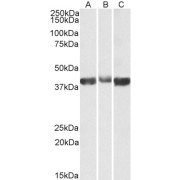 abx431092 (0.03 µg/ml) staining of Human (A), Mouse (B) and Rat (C) Skeletal Muscle lysates (35 µg protein in RIPA buffer). Primary incubation was 1 hour. Detected by chemiluminescence.