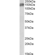 abx431093 (0.03 µg/ml) staining of Rat Brain lysate (35 µg protein in RIPA buffer). Primary incubation was 1 hour. Detected by chemiluminescence.