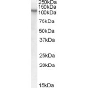 abx431096 (0.3 µg/ml) staining of Human Ileum lysate (35 µg protein in RIPA buffer). Primary incubation was 1 hour. Detected by chemiluminescence.