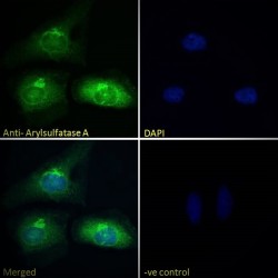 Arylsulfatase A (ARSA) Antibody