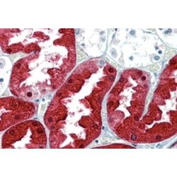 Argininosuccinate Synthetase 1 (ASS1) Antibody