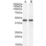 abx431113 (0.03 µg/ml) staining of Human Kidney lysate (35 µg protein in RIPA buffer). Detected by chemiluminescence.