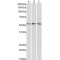 ATP Synthase Subunit Beta, Mitochondrial (ATP5F1B) Antibody