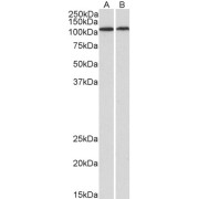 abx431127 (1 µg/ml) staining of Human Heart (A) and Kidney (B) lysates (35 µg protein in RIPA buffer). Detected by chemiluminescence.