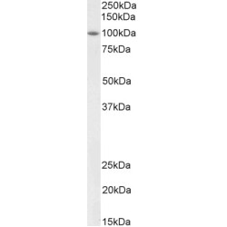 Bone Morphogenetic Protein 1 (BMP1) Antibody