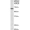 Voltage-Dependent L-Type Calcium Channel Subunit Beta-2 (CACNB2) Antibody