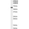 Voltage-Dependent L-Type Calcium Channel Subunit Beta-4 (CACNB4) Antibody