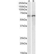 abx431135 (0.01 µg/ml) staining of Human (A) and Rat (B) Lung lysates (35 µg protein in RIPA buffer). Primary incubation was 1 hour. Detected by chemiluminescence.