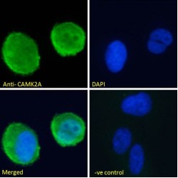 Calcium/Calmodulin Dependent Protein Kinase II Alpha (CAMK2A) Antibody