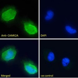 Calcium/Calmodulin Dependent Protein Kinase II Alpha (CAMK2A) Antibody