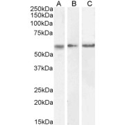 abx431136 (0.3 µg/ml) staining of Human Cerebellum (A), Mouse (B) and Rat (C) Brain lysate (35 µg protein in RIPA buffer). Detected by chemiluminescence