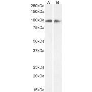 Western blot analysis of Human Cerebellum (A) and (0.5 µg/ml) Rat Brain (B) lysate (35 µg in RIPA buffer) using Calnexin (CANX) Antibody (0.3 µg/ml).