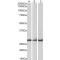 Capping Protein (Actin Filament) Muscle Z-Line, Beta (CAPZB) Antibody