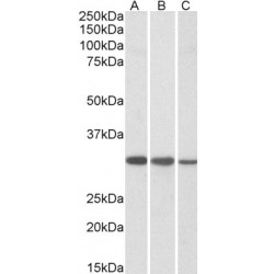 Capping Protein (Actin Filament) Muscle Z-Line, Beta (CAPZB) Antibody