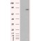 Catenin Alpha 1 (CTNNA1) Antibody