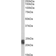 Western blot analysis of Human Spleen lysate (35 µg protein in RIPA buffer) using biotin-conjugated Caveolin 1 (CAV1) Antibody (1 µg/ml, 1 hour). Detected by chemiluminescence, using streptavidin-HRP and using NAP blocker as a substitute for skimmed milk.