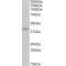 T-Cell-Specific Surface Glycoprotein CD28 (CD28) Antibody