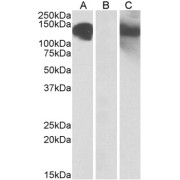 HEK293 lysate (10 µg protein in RIPA buffer) overexpressing Human CDH11 with C-terminal MYC tag probed with abx431153 (1 µg/ml) in Lane A and probed with anti-MYC Tag (1/1000) in lane C. Mock-transfected HEK293 probed with abx431153 (1 mg/ml) in Lane B. Primary incubations were for 1 hour. Detected by chemiluminescence.