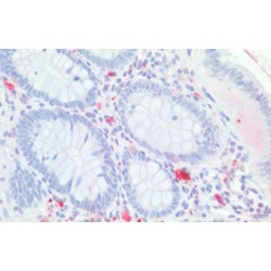 Caudal Type Homeobox Transcription Factor 2 (CDX2) Antibody