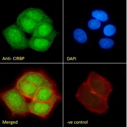 Cold-Inducible RNA-Binding Protein (CIRBP) Antibody