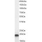 Cold-Inducible RNA-Binding Protein (CIRBP) Antibody