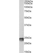 Biotinylated abx431165 (1 µg/ml) staining of Mouse Spleen lysate (35 µg protein in RIPA buffer). Primary incubation was 1 hour. Detected by chemiluminescence, using streptavidin-HRP and using NAP blocker as a substitute for skimmed milk.