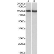 abx431169 (0.03 µg/ml) staining of Mouse (A) and Rat (B) Skeletal Muscle lysate (35 µg protein in RIPA buffer). Primary incubation was 1 hour. Detected by chemiluminescence.