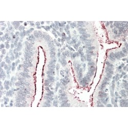 Breast Cancer Anti-Estrogen Resistance Protein 1 (BCAR1) Antibody