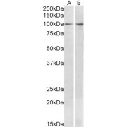 abx431183 (1 µg/ml) staining of MCF7 (A) and Human Breast cancer (B) lysates (35 µg protein in RIPA buffer). Primary incubation was 1 hour. Detected by chemiluminescence.