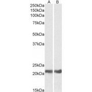 abx431185 (0.05 µg/ml) staining of Mouse (A) and Rat (B) Eye lysates (35 µg protein in RIPA buffer). Primary incubation was 1 hour. Detected by chemiluminescence.