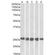 abx431190 (0.3 µg/ml) staining of NIH3T3 (A), HeLa (B), K562 (C), MCF7 (D) and HepG2 (E) lysates (35 µg protein in RIPA buffer). Primary incubation was 1 hour. Detected by chemiluminescence.