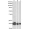 Cysteine And Glycine Rich Protein 3 (CSRP3) Antibody