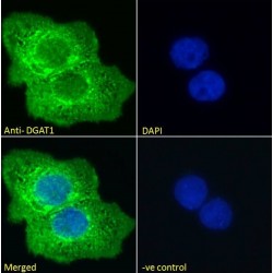 Diacylglycerol O-Acyltransferase 1 (DGAT1) Antibody