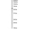 Diacylglycerol O-Acyltransferase 1 (DGAT1) Antibody