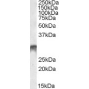 abx431209 (1 µg/ml) staining of Human Bone Marrow lysate (35 µg protein in RIPA buffer). Detected by chemiluminescence.