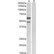 abx431221 (1 µg/ml) staining of Mouse fetal Lung lysate (35 µg protein in RIPA buffer) with (B) and without (A) blocking with the immunizing peptide. Primary incubation was 1 hour. Detected by chemiluminescence.