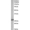 Ephrin A1 (EFNA1) Antibody