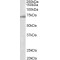 Ectoderm-Neural Cortex Protein 1 (ENC1) Antibody