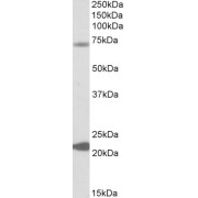 abx431238 (0.3 µg/ml) staining of Human Liver lysate (35 µg protein in RIPA buffer). Primary incubation was 1 hour. Detected by chemiluminescence.